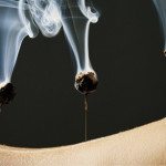 moxibustion